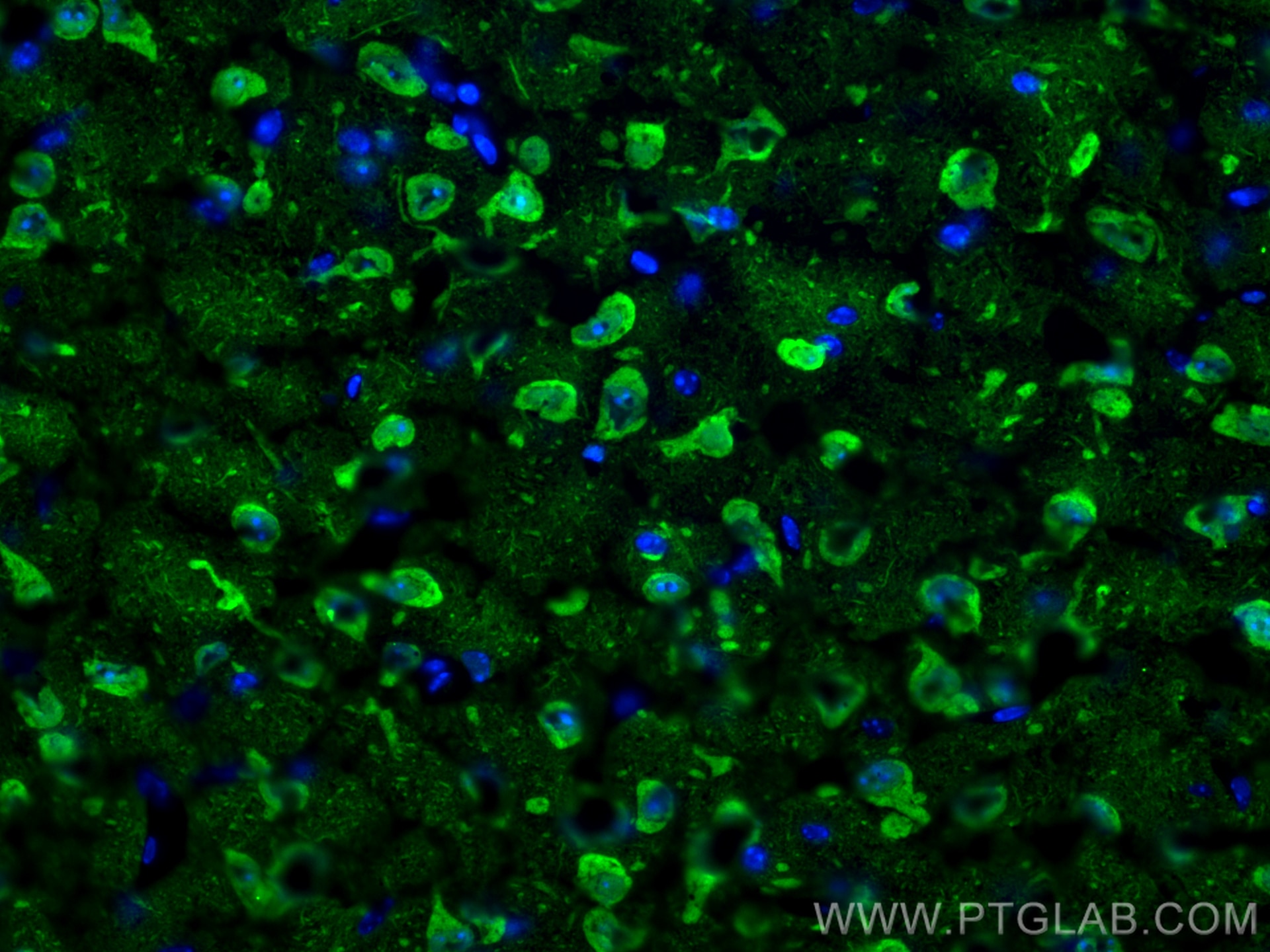 Immunofluorescence (IF) / fluorescent staining of mouse brain tissue using UCH-L1/PGP9.5 Polyclonal antibody (14730-1-AP)