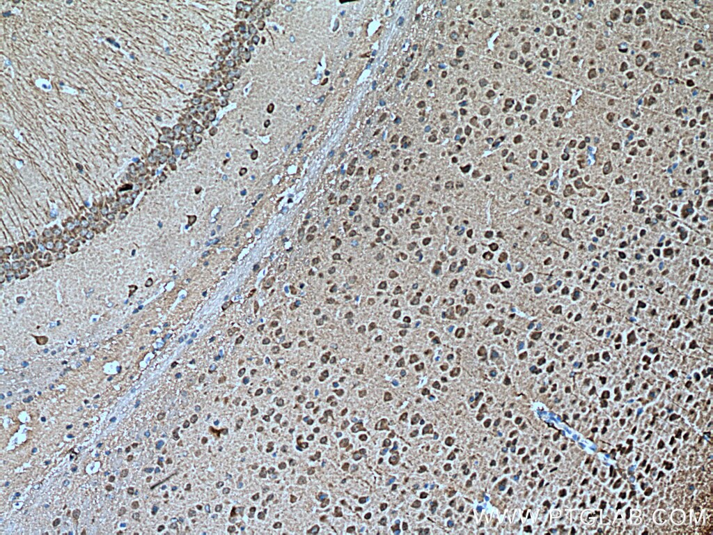 IHC staining of mouse brain using 14730-1-AP