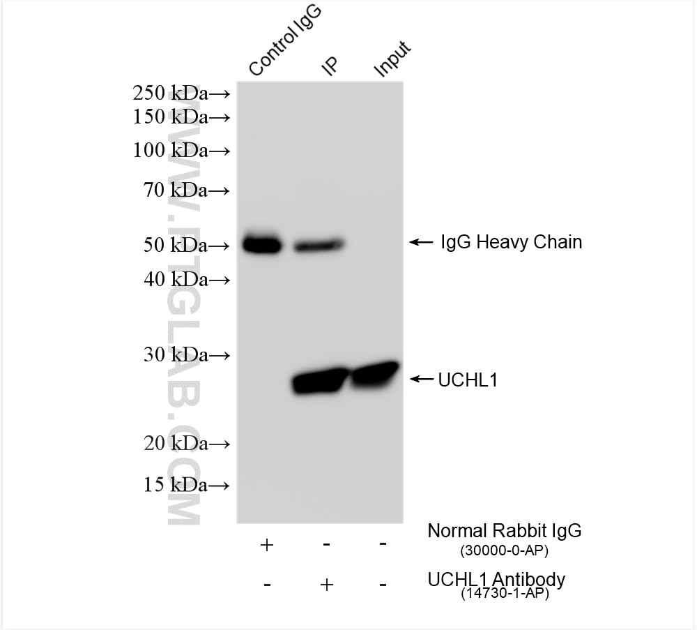 Immunoprecipitation (IP) experiment of A549 cells using UCH-L1/PGP9.5 Polyclonal antibody (14730-1-AP)