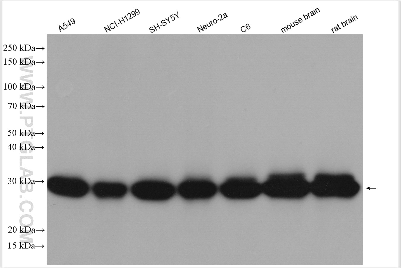 Western Blot (WB) analysis of various lysates using UCHL1/PGP9.5 Polyclonal antibody (14730-1-AP)