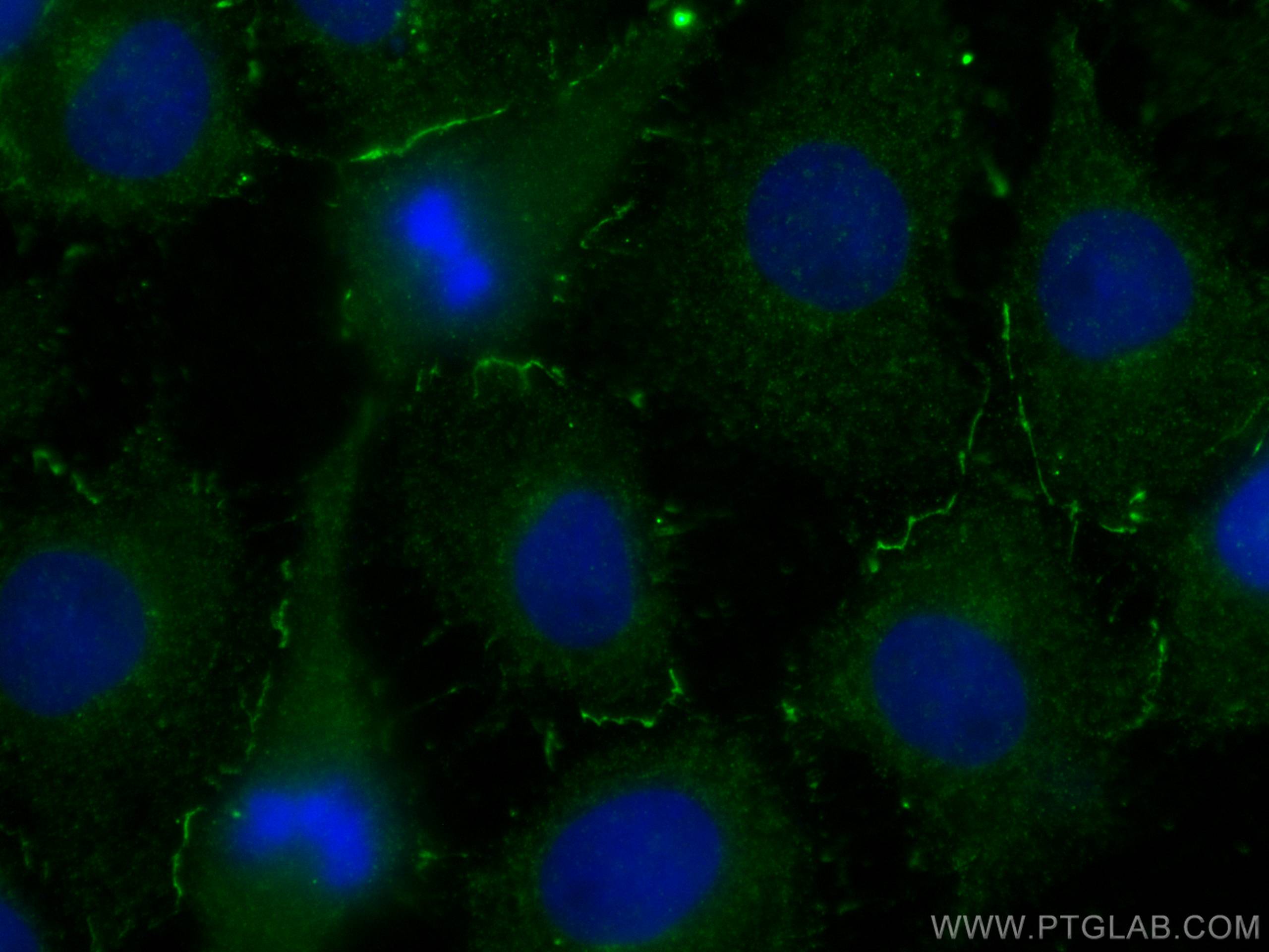 Immunofluorescence (IF) / fluorescent staining of SH-SY5Y cells using UCHL1/PGP9.5 Monoclonal antibody (66230-1-Ig)