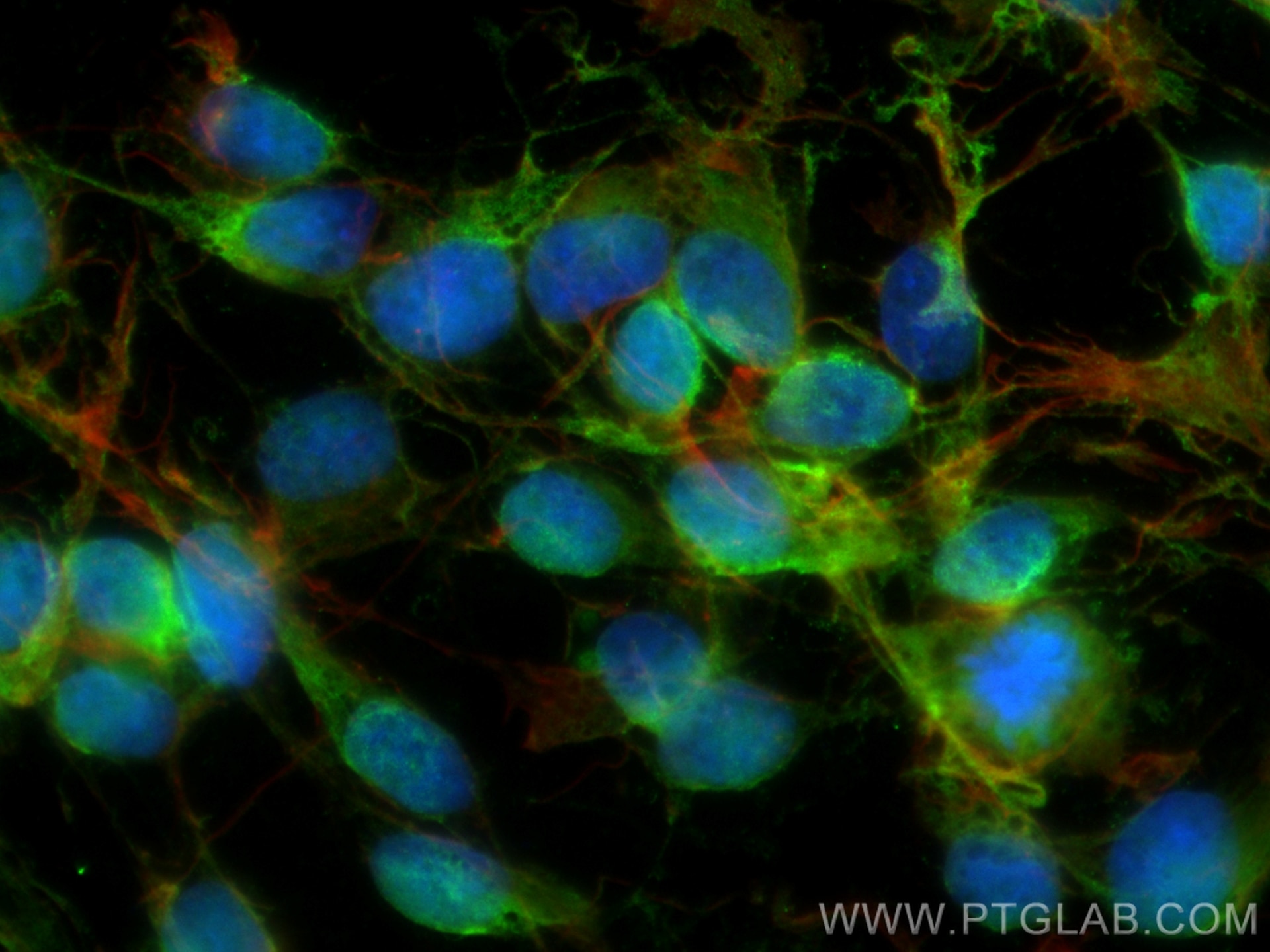 Immunofluorescence (IF) / fluorescent staining of SH-SY5Y cells using UCHL1/PGP9.5 Monoclonal antibody (66230-1-Ig)