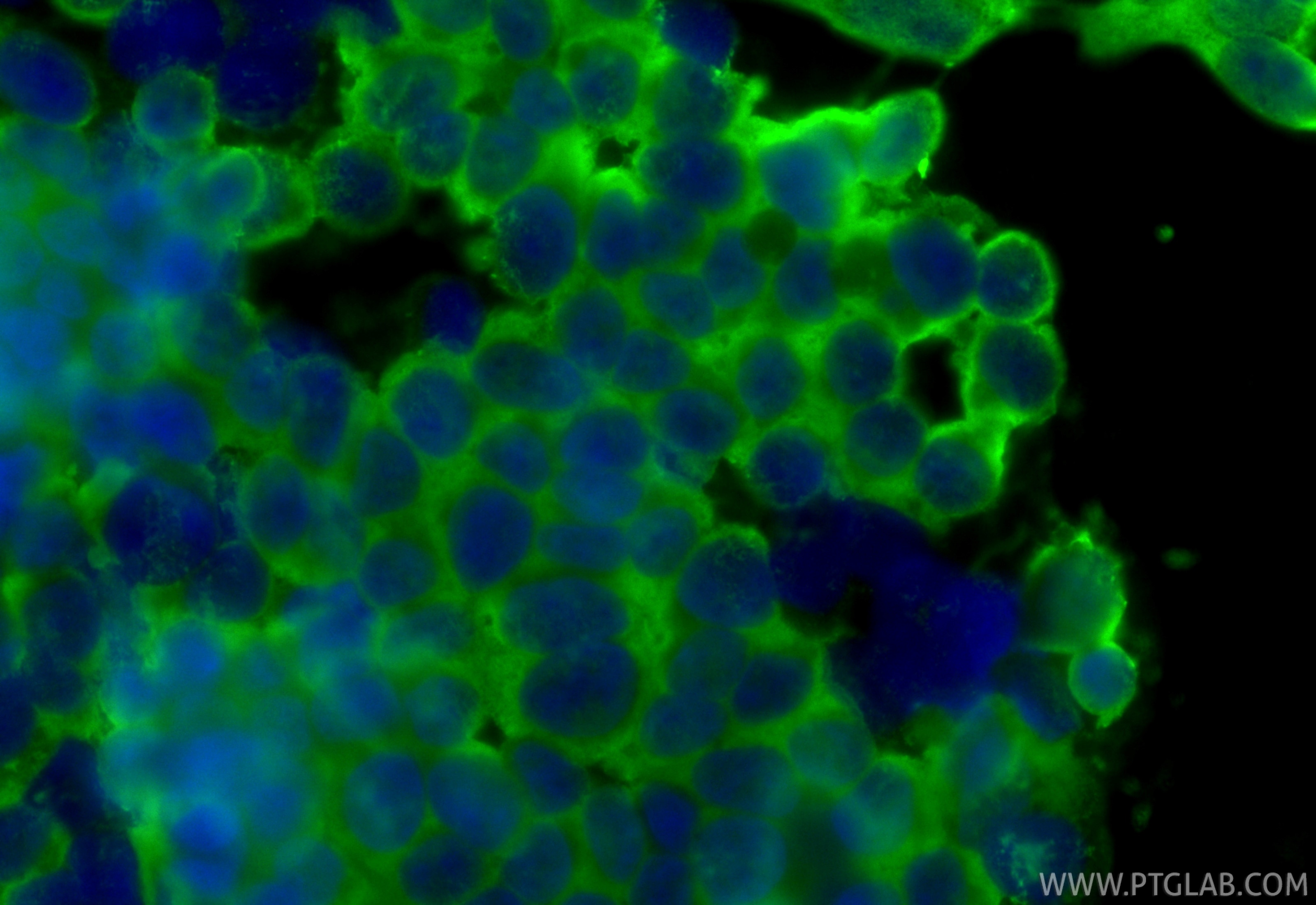 Immunofluorescent analysis of (-20°C Ethanol) fixed SH-SY5Y cells using UCH-L1/PGP9.5 antibody (66230-1-Ig, Clone: 1C9E11 ) at dilution of 1:800 and CoraLite®488-Conjugated Goat Anti-Mouse IgG(H+L) (SA00013-1). Immunofluorescence (IF) / fluorescent staining of SH-SY5Y cells using UCH-L1/PGP9.5 Monoclonal antibody (66230-1-Ig)