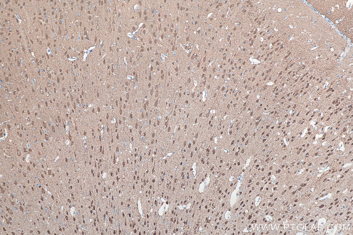 IHC staining of rat brain using 66230-1-Ig Immunohistochemistry (IHC) staining of rat brain tissue using UCH-L1/PGP9.5 Monoclonal antibody (66230-1-Ig)