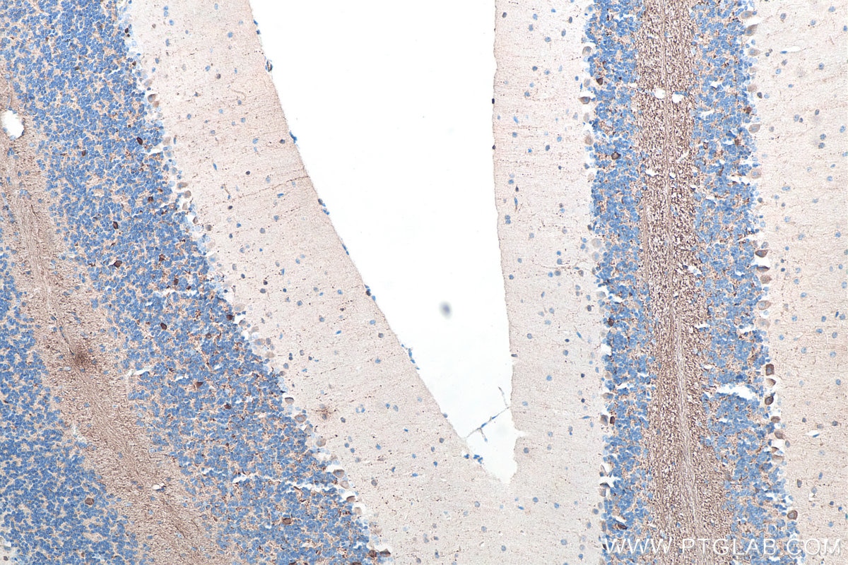 Immunohistochemistry (IHC) staining of mouse cerebellum tissue using UCHL1/PGP9.5 Monoclonal antibody (66230-1-Ig)