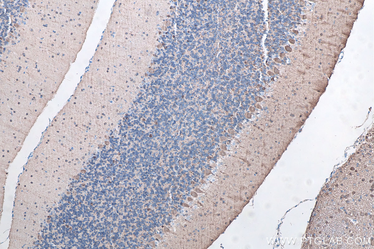 Immunohistochemistry (IHC) staining of rat cerebellum tissue using UCHL1/PGP9.5 Monoclonal antibody (66230-1-Ig)