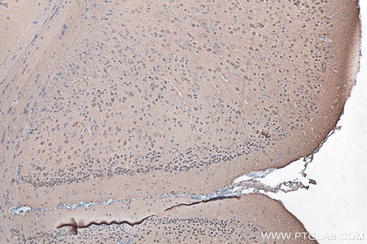 IHC staining of mouse brain using 66230-1-Ig Immunohistochemistry (IHC) staining of mouse brain tissue using UCH-L1/PGP9.5 Monoclonal antibody (66230-1-Ig)