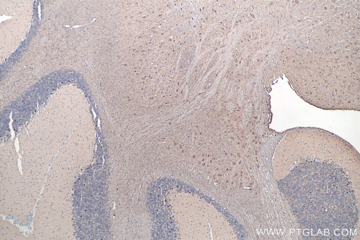 IHC staining of rat cerebellum using 66230-1-Ig Immunohistochemistry (IHC) staining of rat cerebellum tissue using UCH-L1/PGP9.5 Monoclonal antibody (66230-1-Ig)