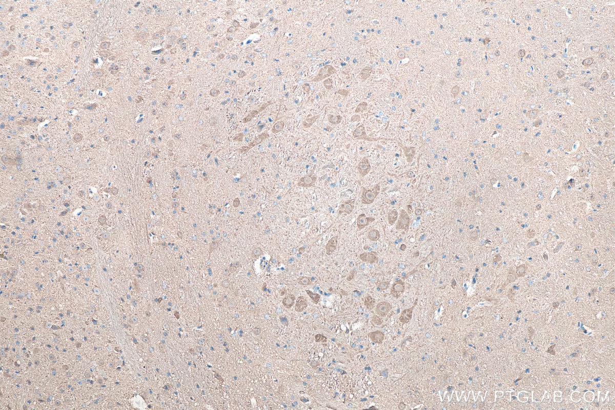IHC staining of mouse cerebellum using 66230-1-Ig Immunohistochemistry (IHC) staining of mouse cerebellum tissue using UCH-L1/PGP9.5 Monoclonal antibody (66230-1-Ig)