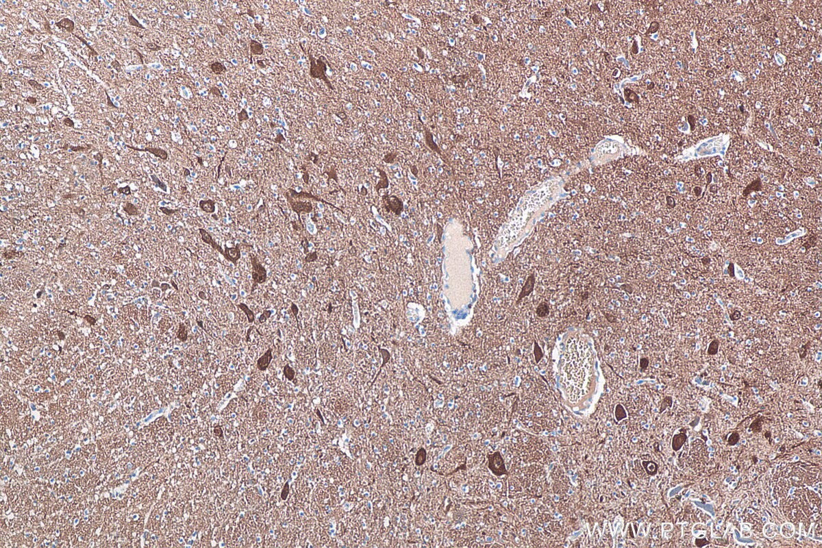 IHC staining of human hypothalamus using 66230-1-Ig Immunohistochemistry (IHC) staining of human hypothalamus tissue using UCH-L1/PGP9.5 Monoclonal antibody (66230-1-Ig)