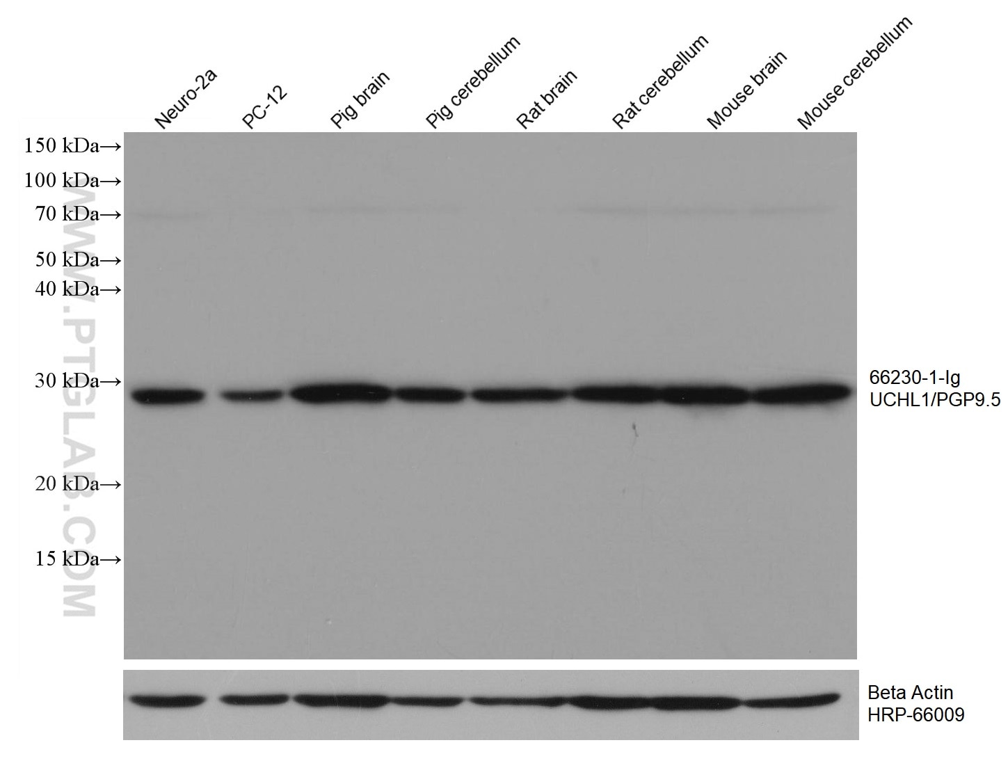 Western Blot (WB) analysis of various lysates using UCHL1/PGP9.5 Monoclonal antibody (66230-1-Ig)