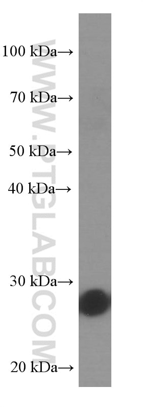 Western Blot (WB) analysis of fetal human brain tissue using UCHL1/PGP9.5 Monoclonal antibody (66230-1-Ig)