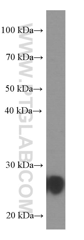 Western Blot (WB) analysis of pig brain tissue using UCHL1/PGP9.5 Monoclonal antibody (66230-1-Ig)