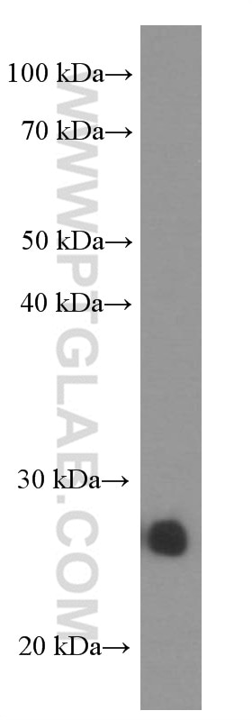 Western Blot (WB) analysis of mouse brain tissue using UCHL1/PGP9.5 Monoclonal antibody (66230-1-Ig)