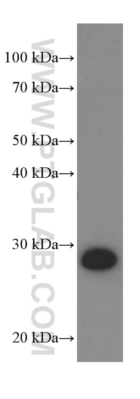 Western Blot (WB) analysis of Y79 cells using UCHL1/PGP9.5 Monoclonal antibody (66230-1-Ig)