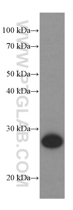Western Blot (WB) analysis of Neuro-2a cells using UCHL1/PGP9.5 Monoclonal antibody (66230-1-Ig)