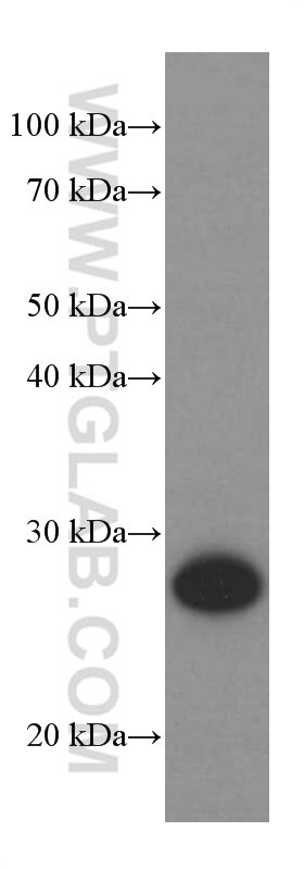 WB analysis of Neuro-2a using 66230-1-Ig