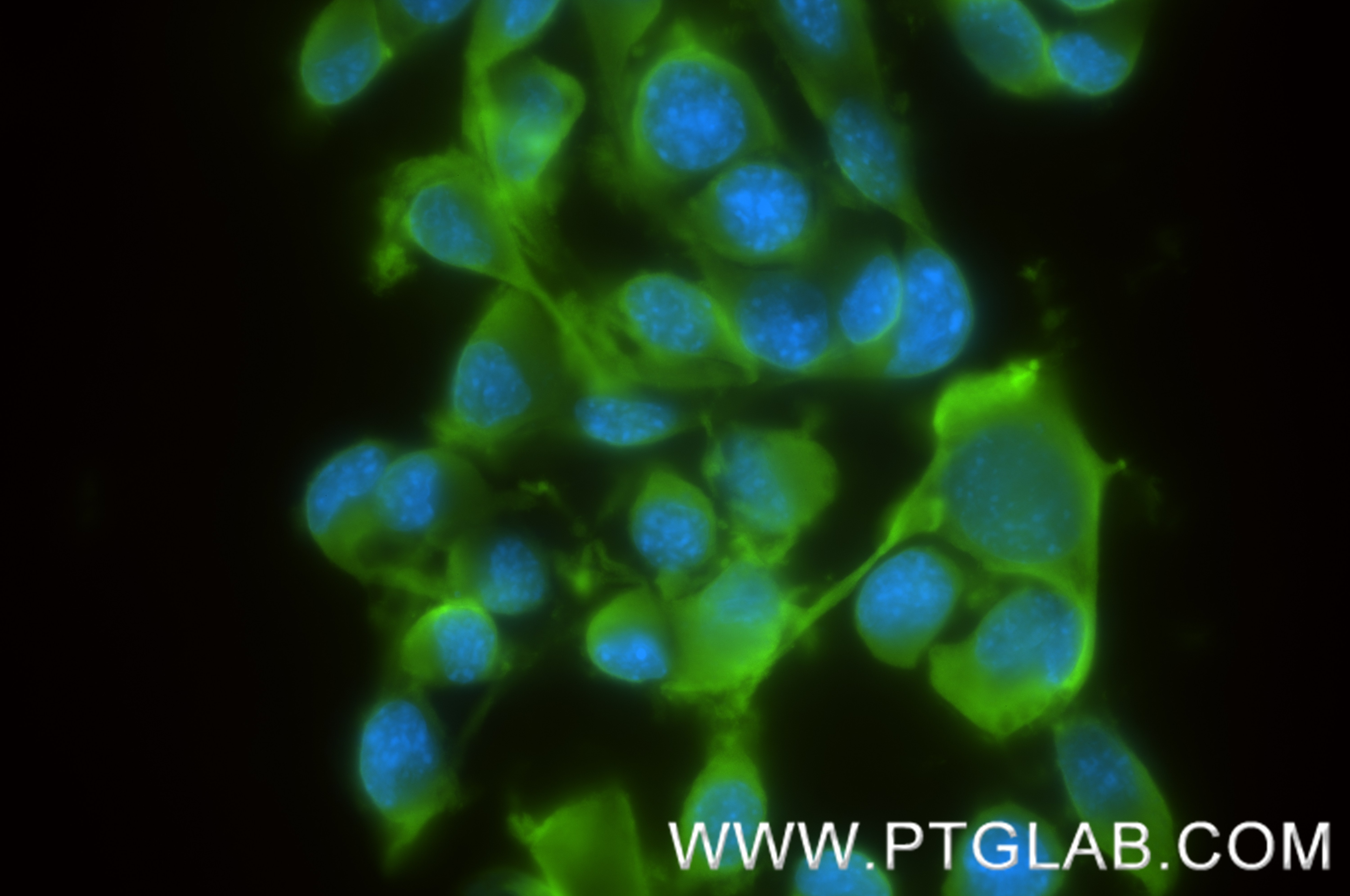 Immunofluorescence (IF) / fluorescent staining of Neuro-2a cells using UCH-L1/PGP9.5 Recombinant antibody (84154-4-RR)