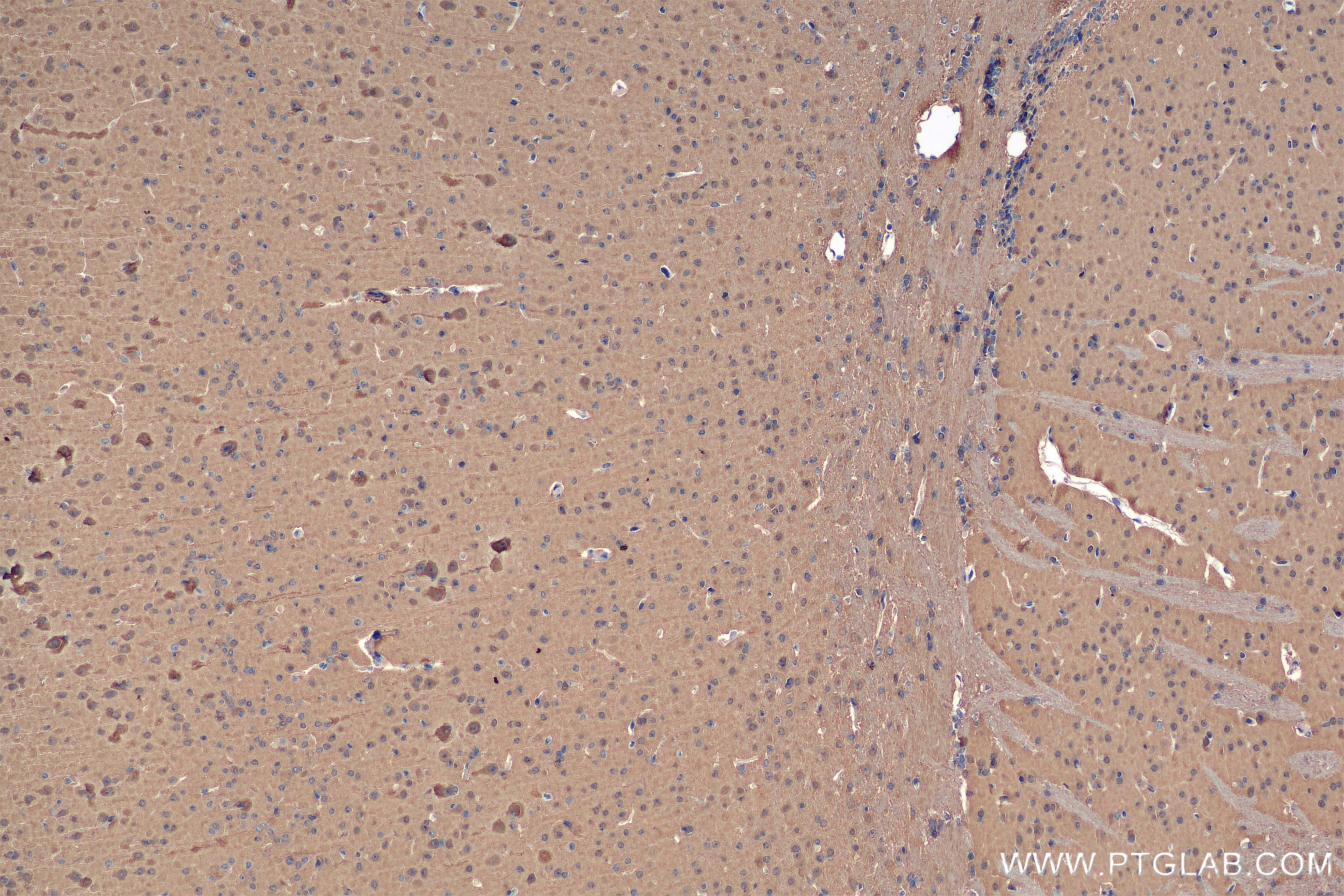 Immunohistochemistry (IHC) staining of mouse brain tissue using UCH-L1/PGP9.5 Recombinant antibody (84154-5-RR)