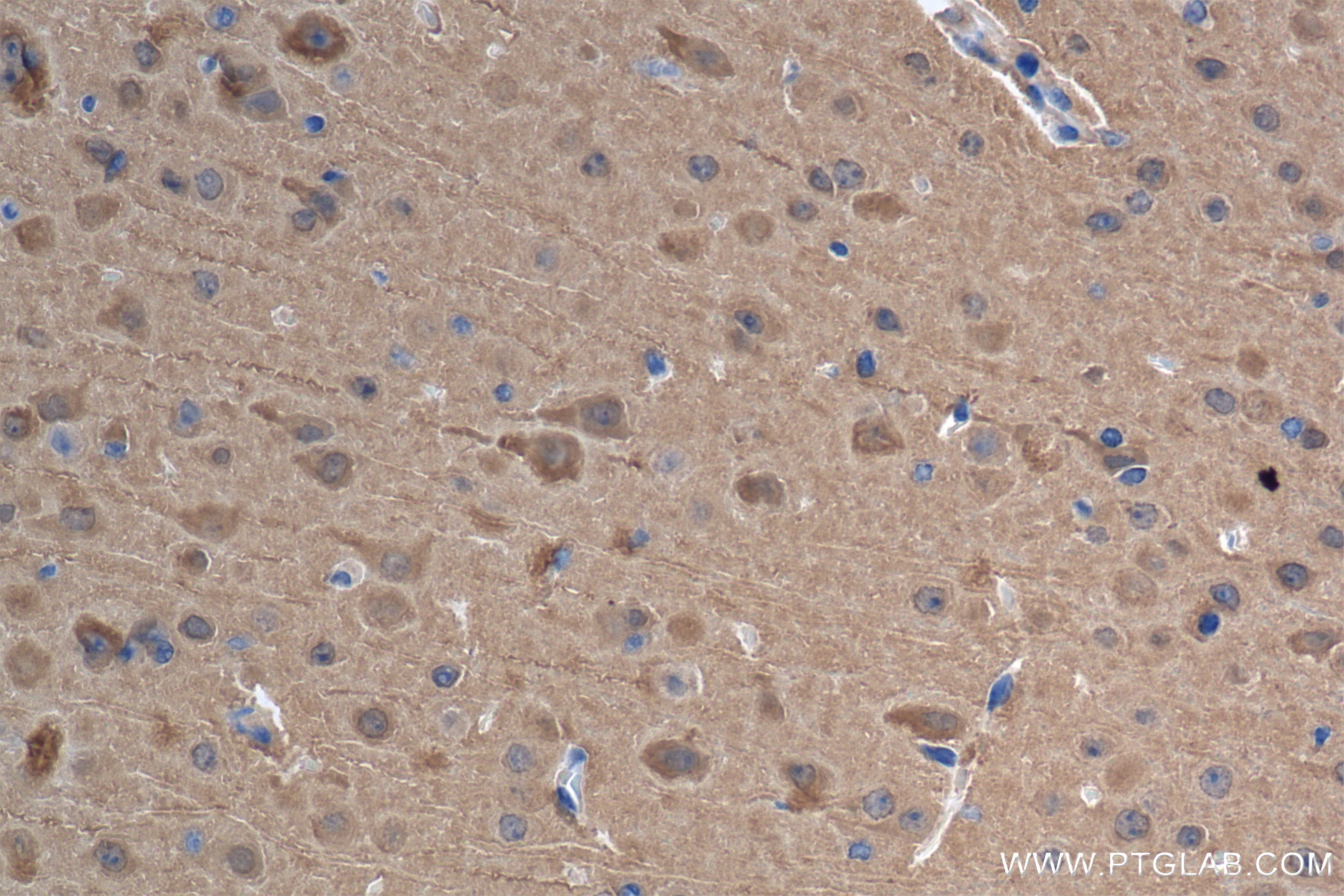 Immunohistochemistry (IHC) staining of mouse brain tissue using UCH-L1/PGP9.5 Recombinant antibody (84154-5-RR)