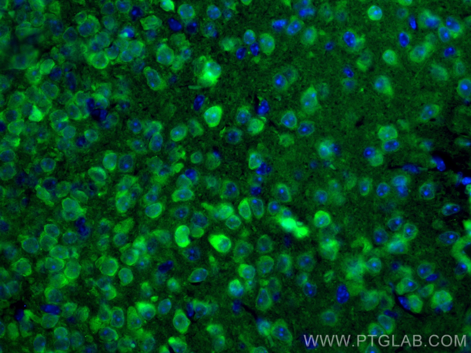 Immunofluorescence (IF) / fluorescent staining of mouse brain tissue using CoraLite® Plus 488-conjugated UCHL1/PGP9.5 Monoclo (CL488-66230)