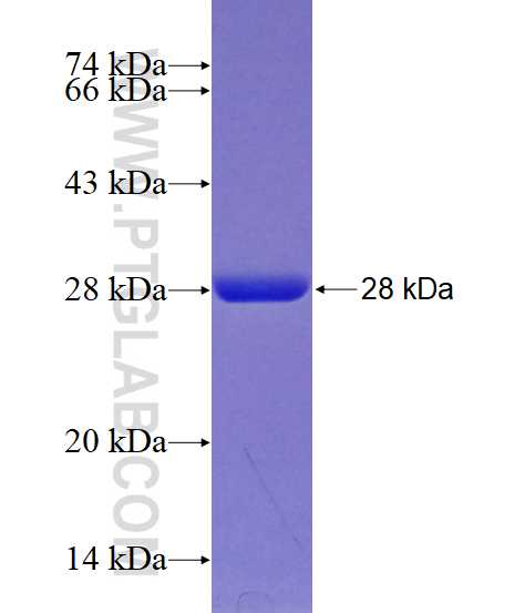 UCHL1 fusion protein Ag6547 SDS-PAGE