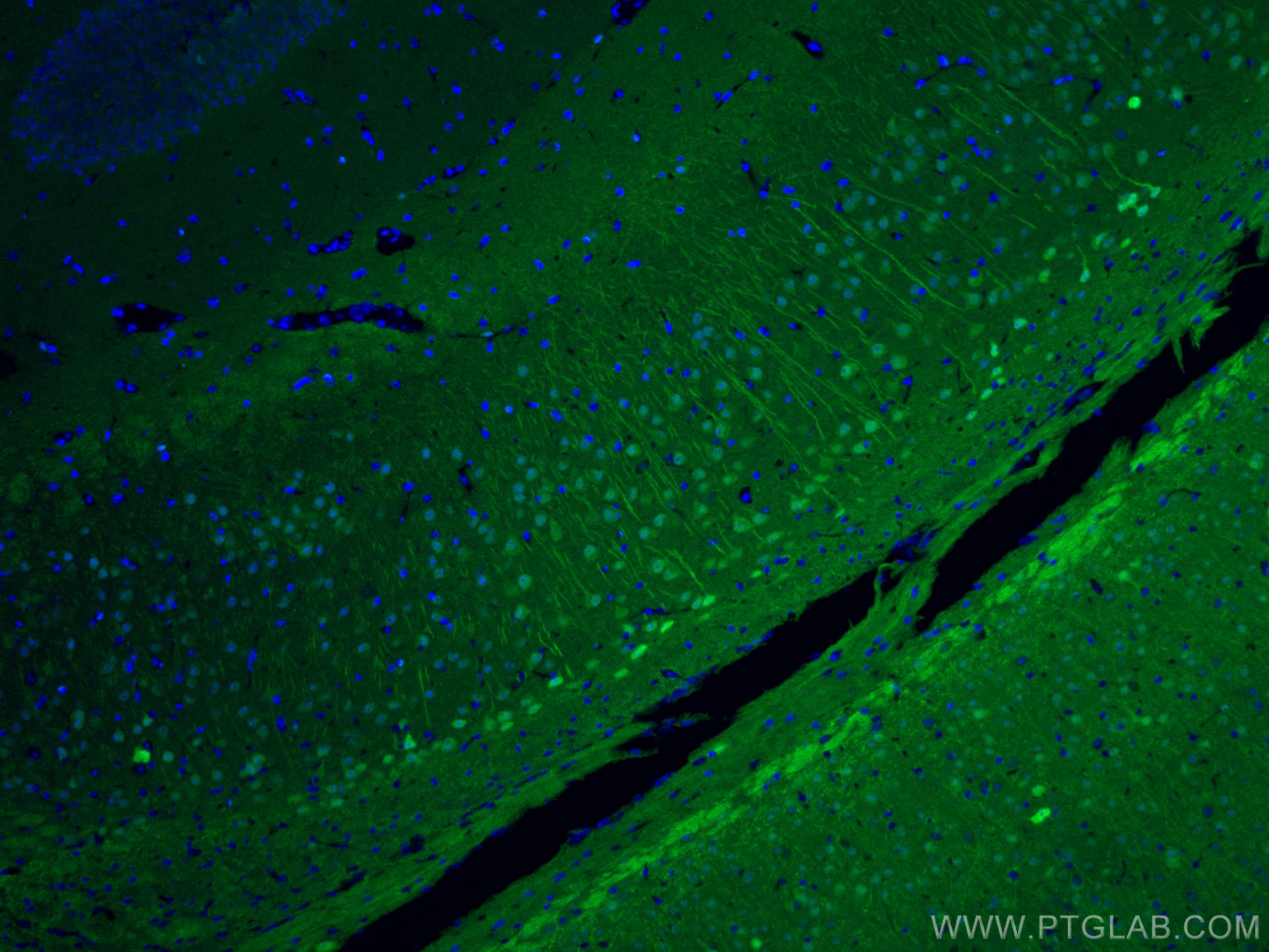 Immunofluorescence (IF) / fluorescent staining of mouse brain tissue using CoraLite® Plus 488-conjugated UCHL1/PGP9.5 Polyclo (CL488-14730)