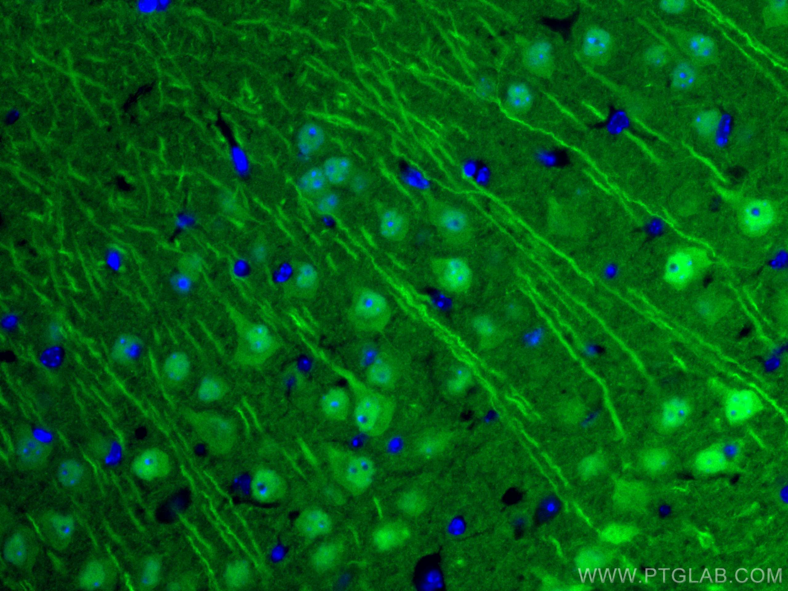 IF Staining of mouse brain using CL488-14730