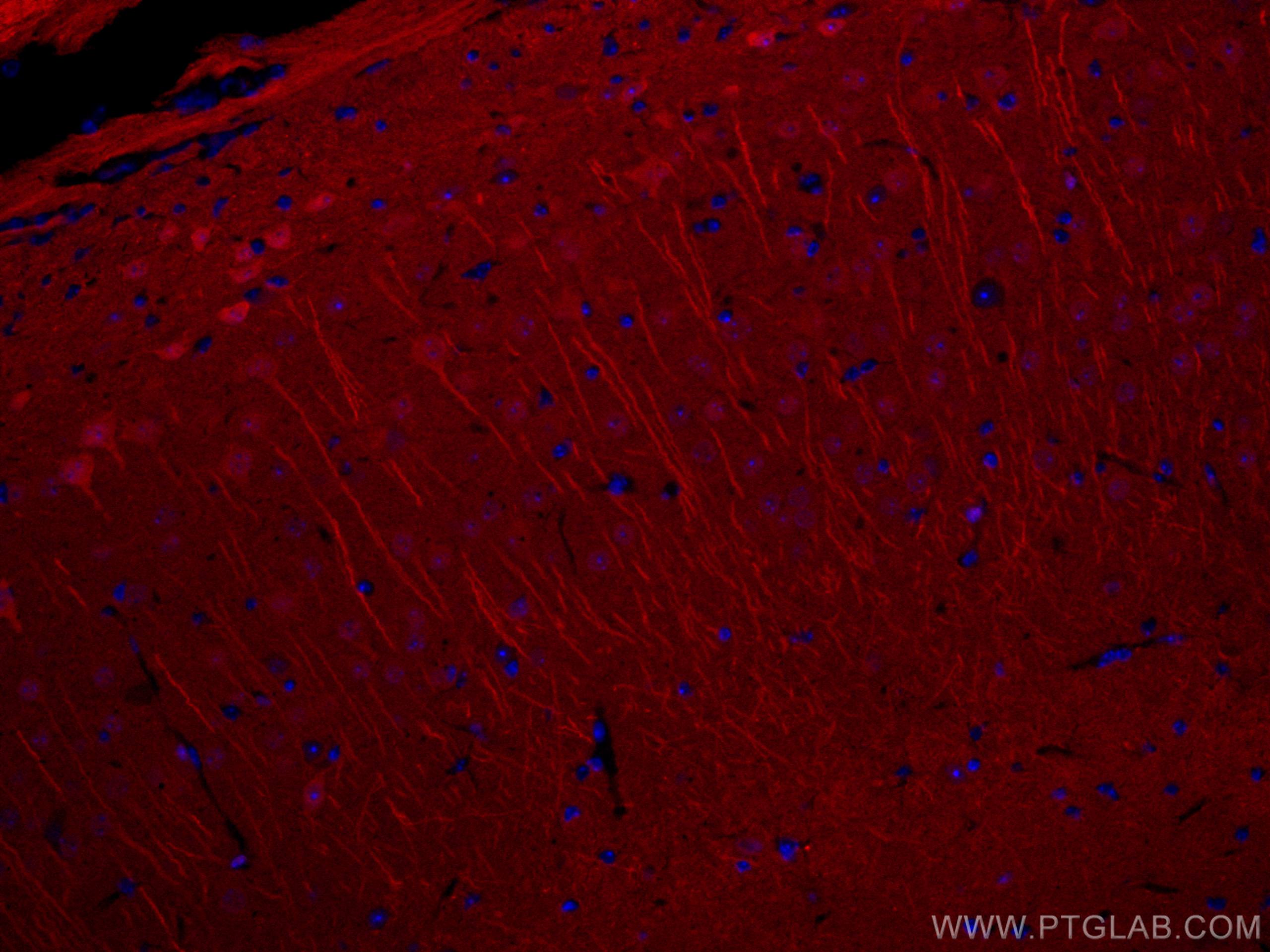 IF Staining of mouse brain using CL594-14730