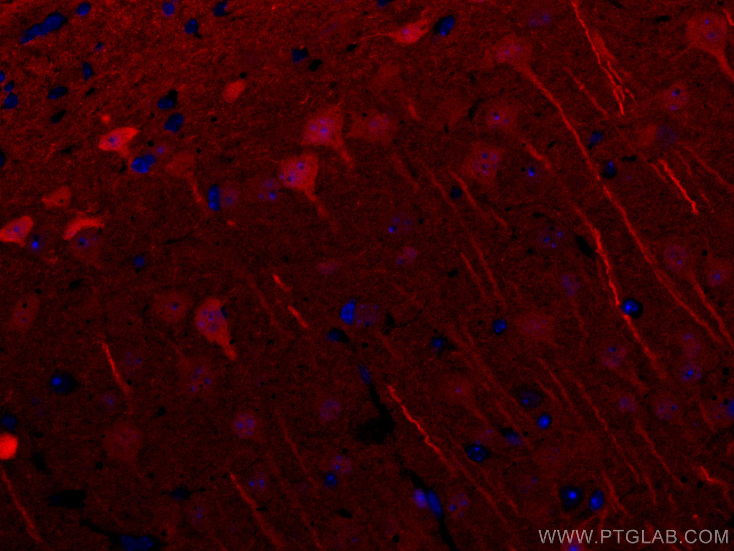 IF Staining of mouse brain using CL594-14730