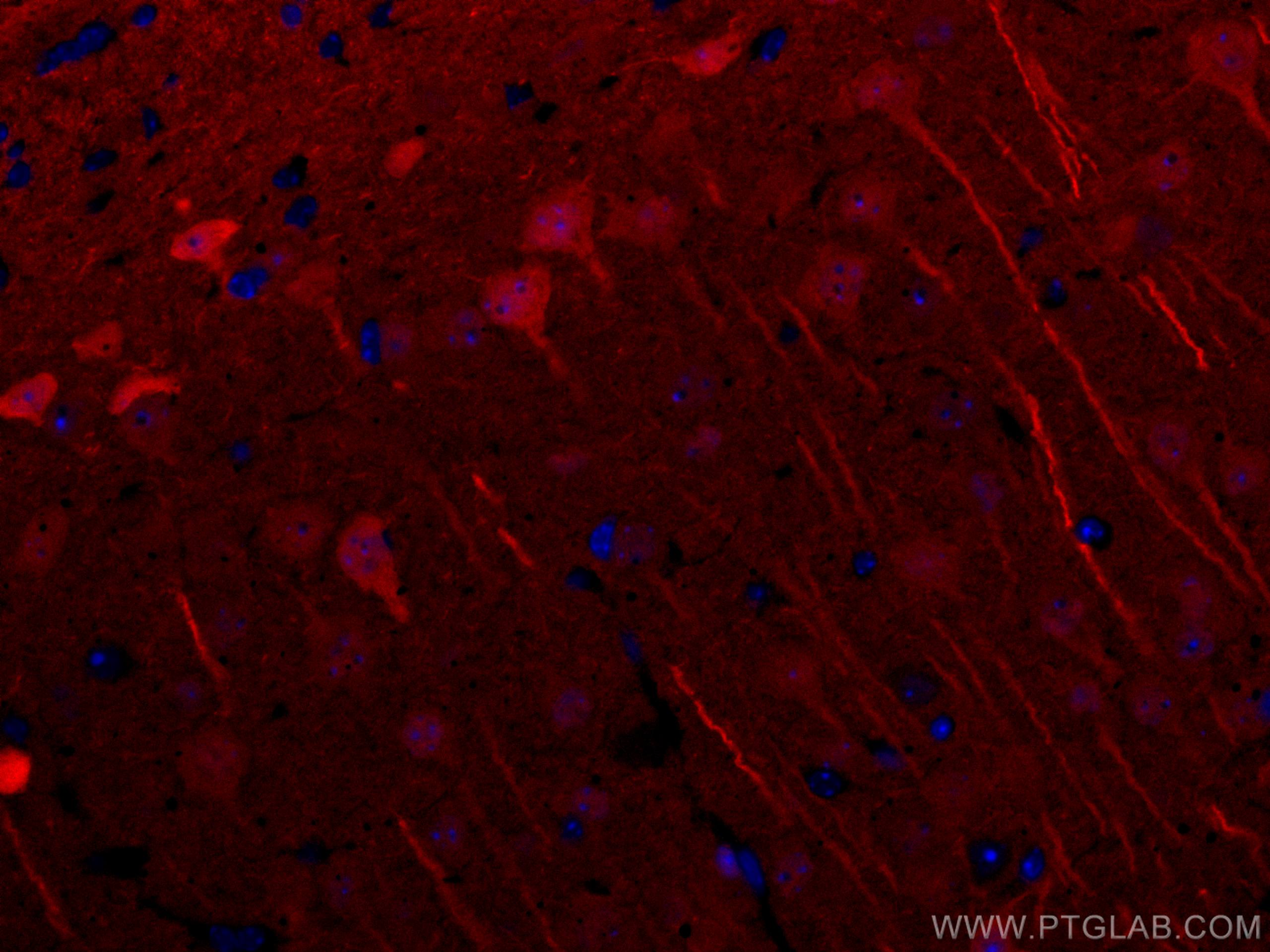 Immunofluorescence (IF) / fluorescent staining of mouse brain tissue using CoraLite®594-conjugated UCHL1/PGP9.5 Polyclonal an (CL594-14730)