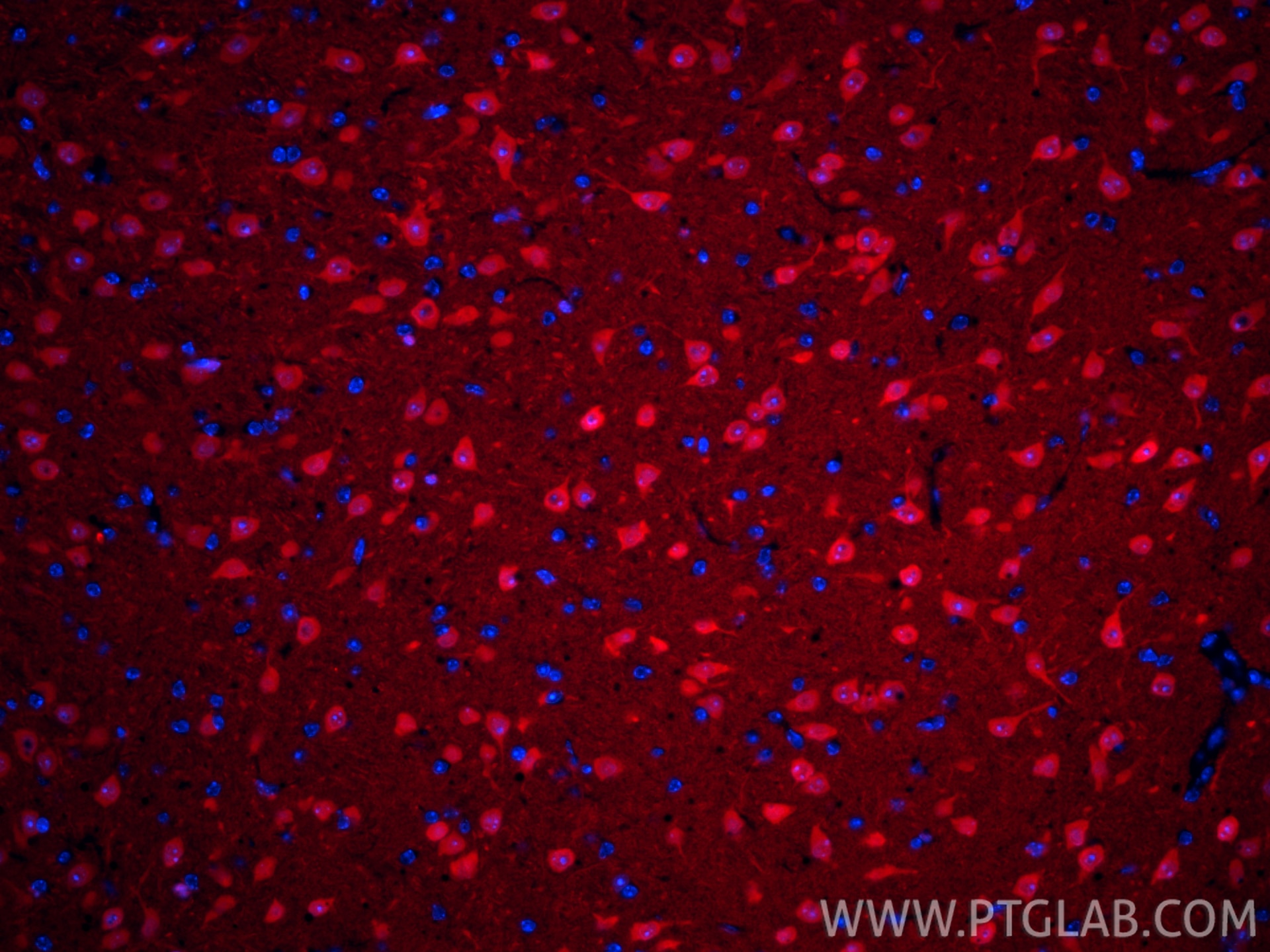 IF Staining of mouse brain using CL594-66230 Immunofluorescence (IF) / fluorescent staining of mouse brain tissue using CoraLite®594-conjugated UCH-L1/PGP9.5 Monoclonal a (CL594-66230)