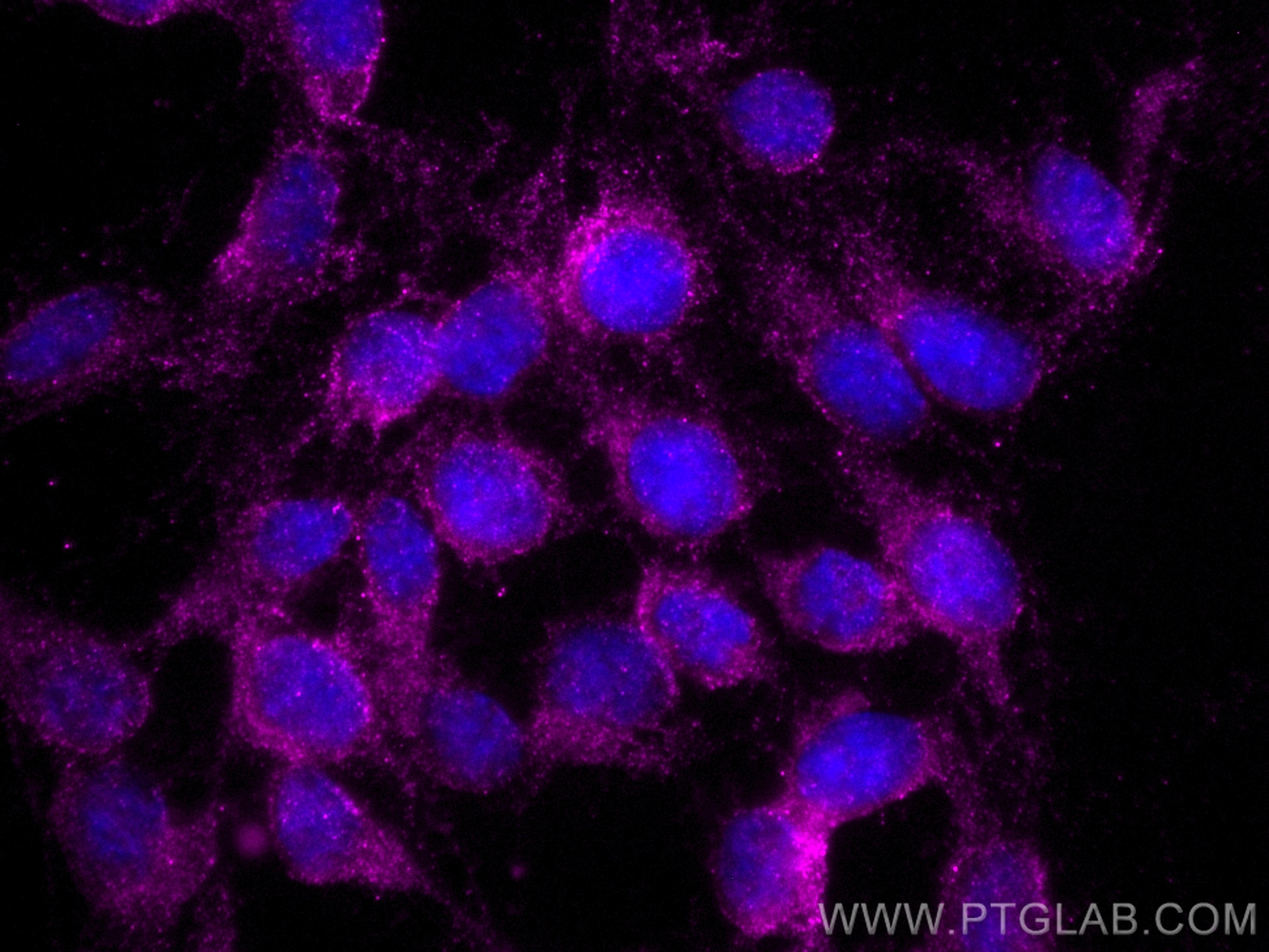 Immunofluorescence (IF) / fluorescent staining of SH-SY5Y cells using CoraLite® Plus 647-conjugated UCHL1/PGP9.5 Monoclo (CL647-66230)