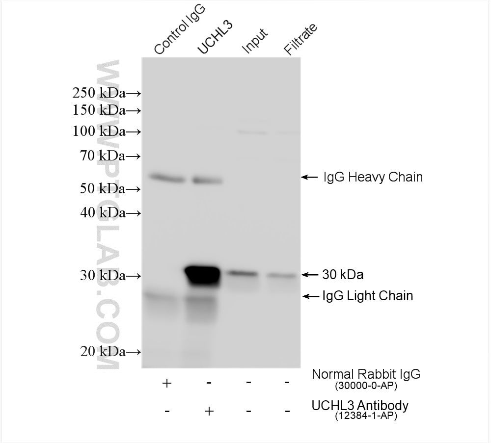 Immunoprecipitation (IP) experiment of HeLa cells using UCHL3 Polyclonal antibody (12384-1-AP)