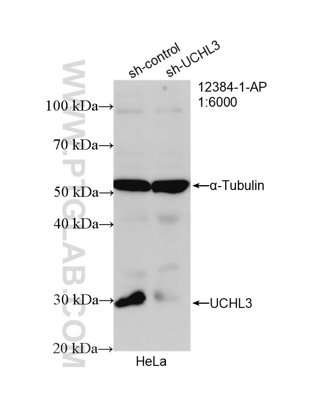 Western Blot (WB) analysis of HeLa cells using UCHL3 Polyclonal antibody (12384-1-AP)