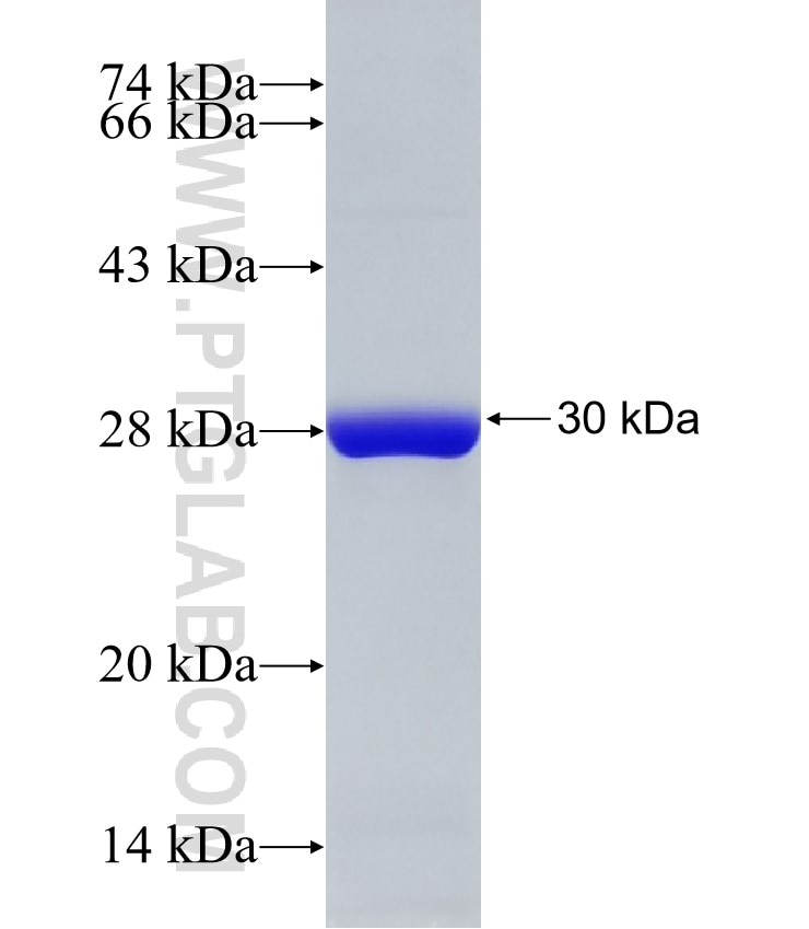 UCHL3 fusion protein Ag32925 SDS-PAGE UCHL3 fusion protein Ag32925 SDS-PAGE