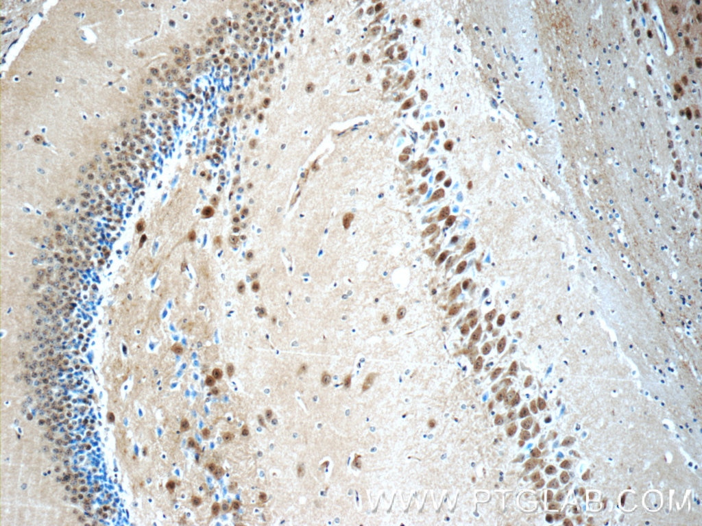 Immunohistochemistry (IHC) staining of mouse brain tissue using UCHL5 Polyclonal antibody (11527-1-AP)