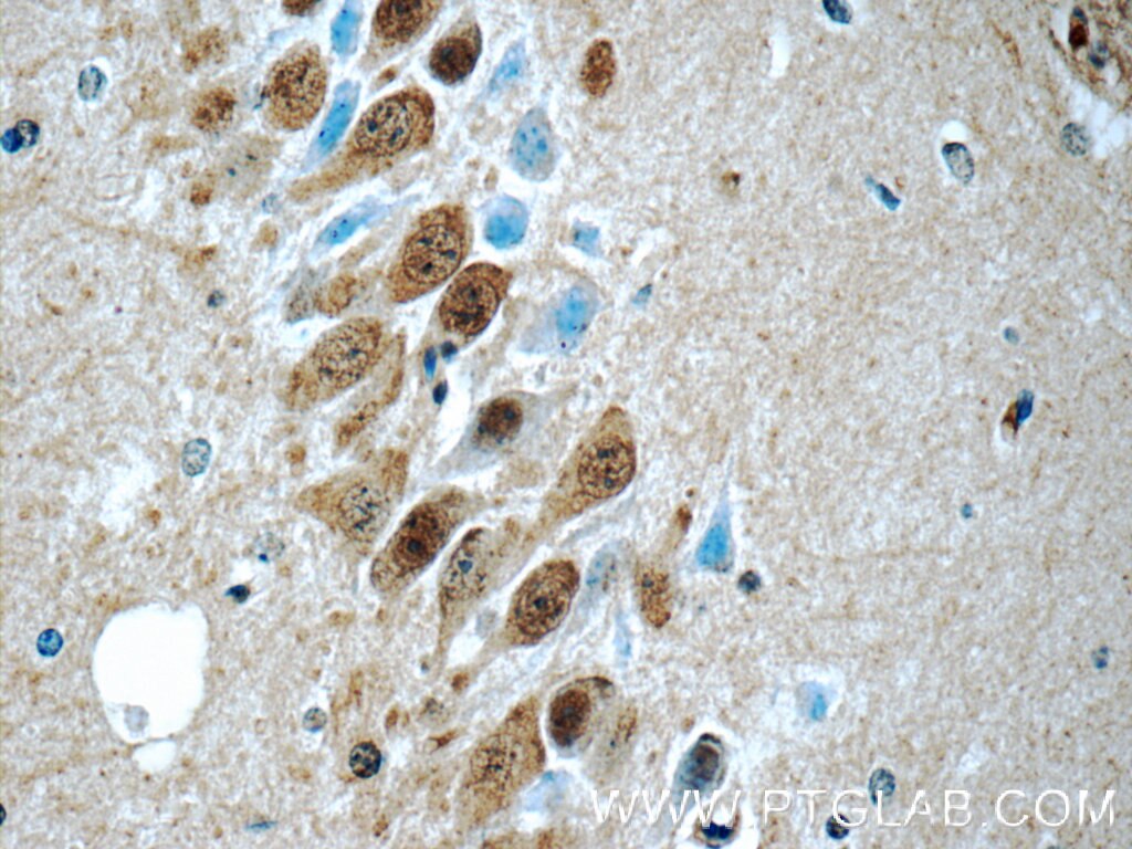 Immunohistochemistry (IHC) staining of mouse brain tissue using UCHL5 Polyclonal antibody (11527-1-AP)