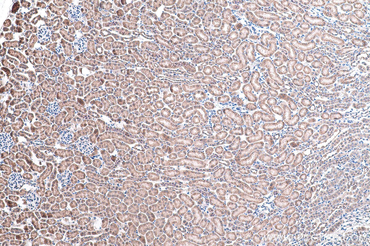 Immunohistochemistry (IHC) staining of mouse kidney tissue using UCHL5 Polyclonal antibody (11527-1-AP)