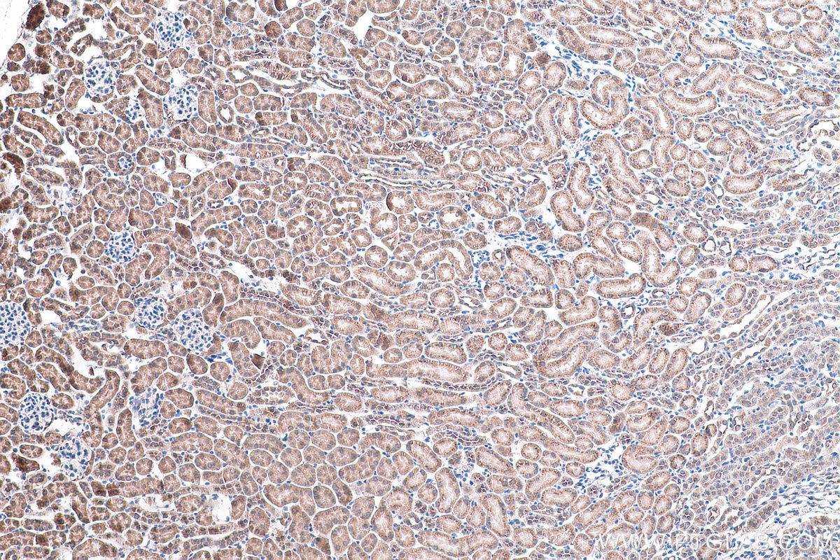 IHC staining of mouse kidney using 11527-1-AP