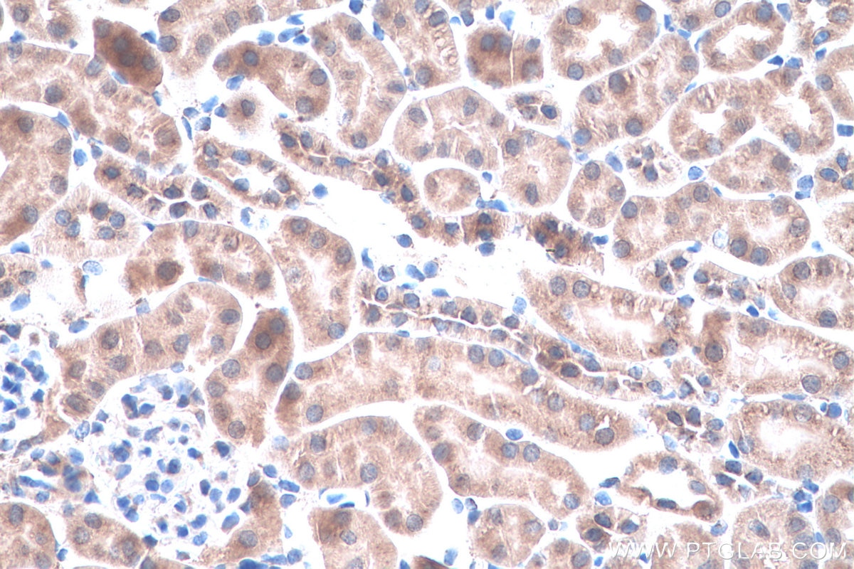 IHC staining of mouse kidney using 11527-1-AP