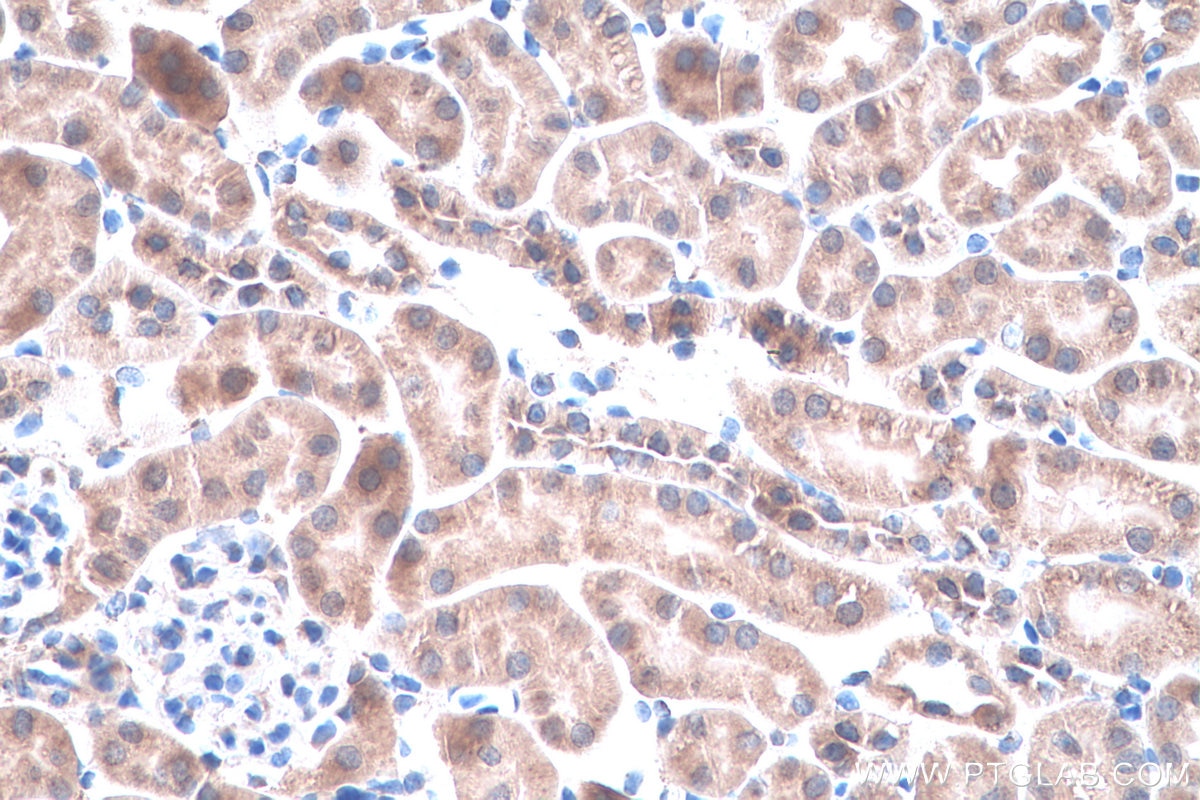 Immunohistochemistry (IHC) staining of mouse kidney tissue using UCHL5 Polyclonal antibody (11527-1-AP)