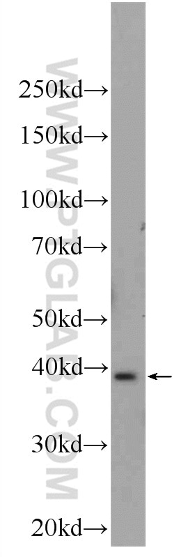 Western Blot (WB) analysis of mouse brain tissue using UCHL5 Polyclonal antibody (11527-1-AP)