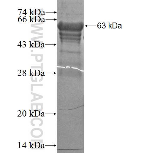 UCHL5 fusion protein Ag2095 SDS-PAGE
