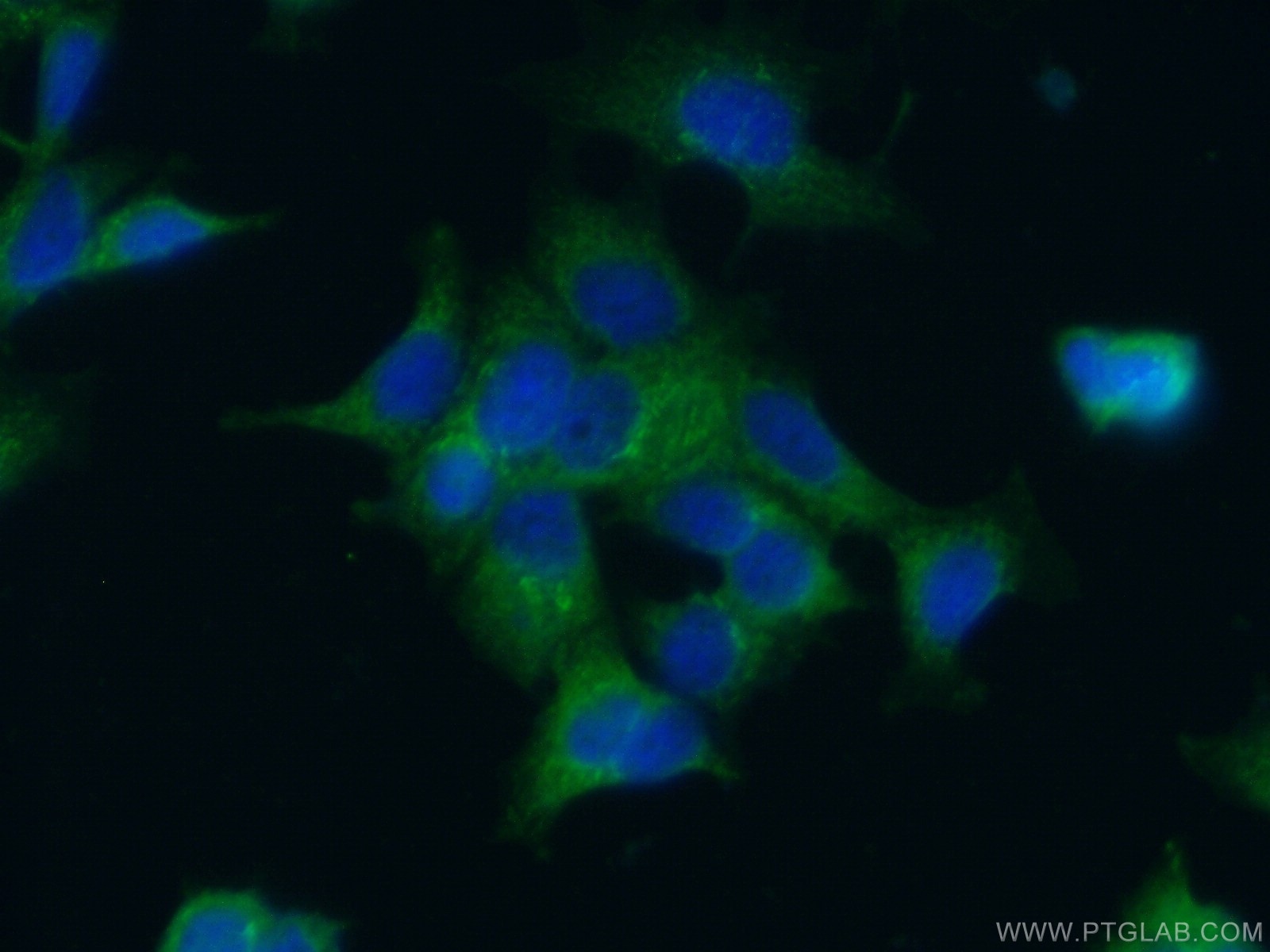 Immunofluorescence (IF) / fluorescent staining of MCF-7 cells using UCHL5IP Polyclonal antibody (17830-1-AP)