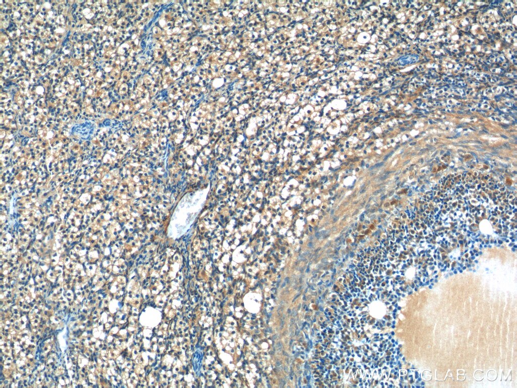 Immunohistochemistry (IHC) staining of human ovary tissue using UCHL5IP Polyclonal antibody (17830-1-AP)