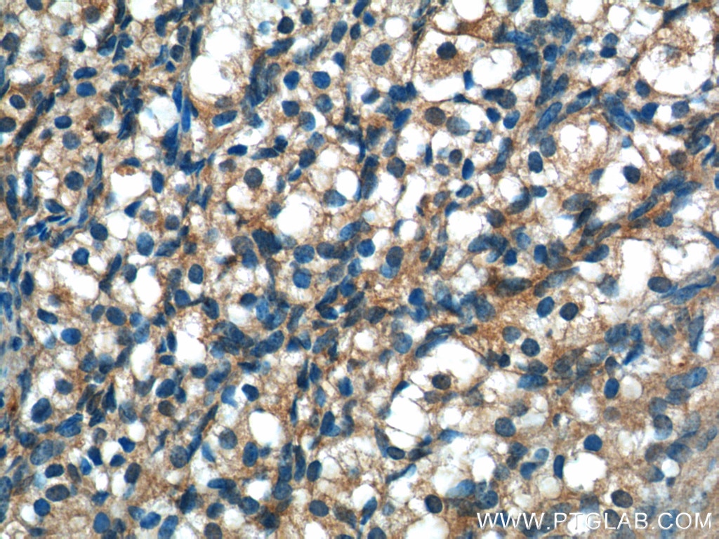 Immunohistochemistry (IHC) staining of human ovary tissue using UCHL5IP Polyclonal antibody (17830-1-AP)