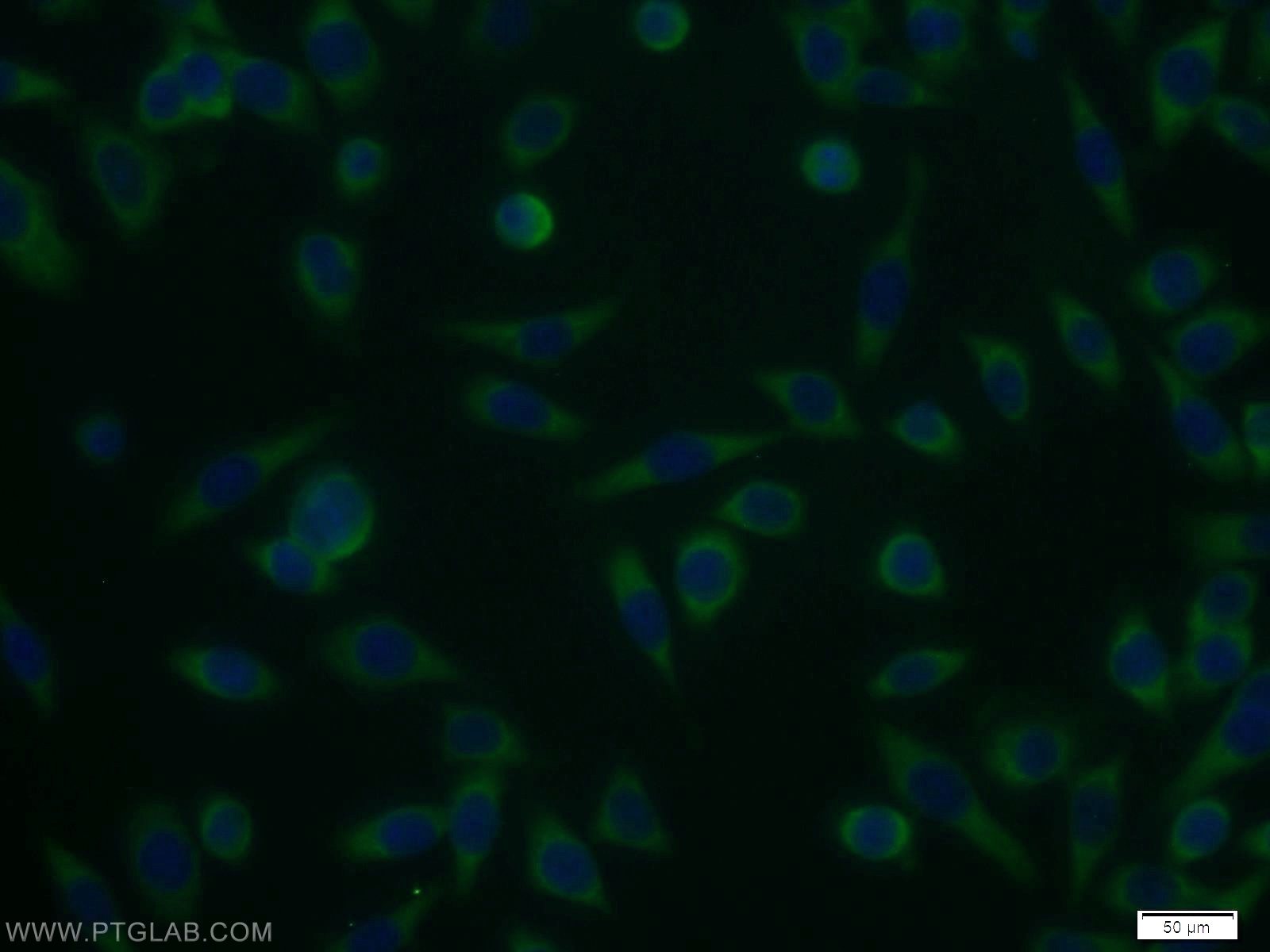 Immunofluorescence (IF) / fluorescent staining of MCF-7 cells using UCK1 Polyclonal antibody (12271-1-AP)
