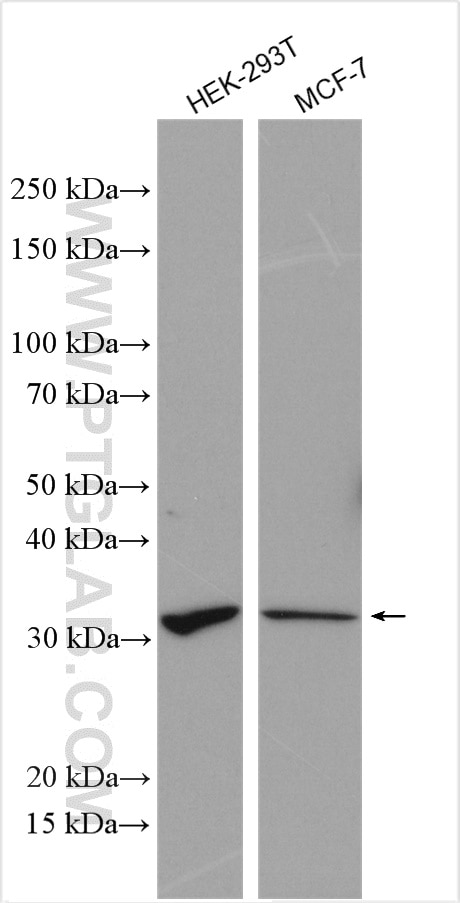 Western Blot (WB) analysis of various lysates using UCK1 Polyclonal antibody (12271-1-AP)