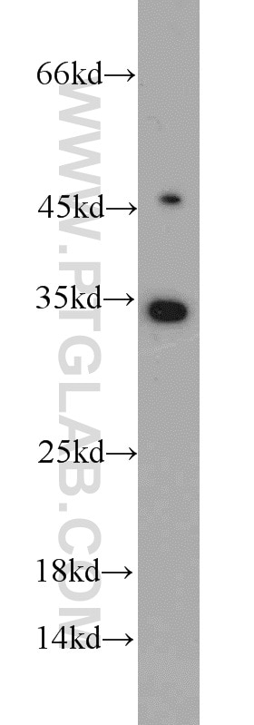 Western Blot (WB) analysis of MCF-7 cells using UCK1 Polyclonal antibody (12271-1-AP)